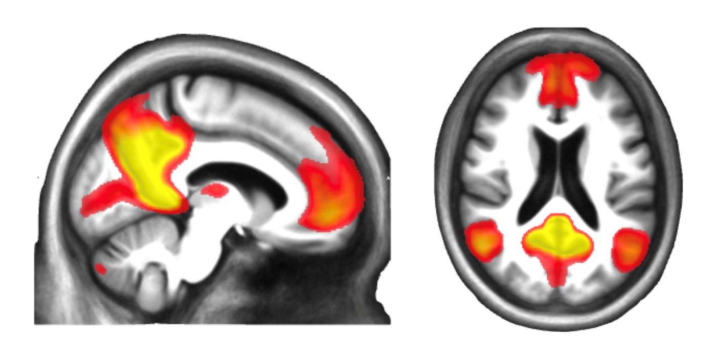 Default Mode Network (DMN24) seed-based group spatial map — sagittal and axial views